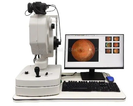Fundus with FFA