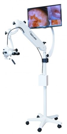 Colposcope